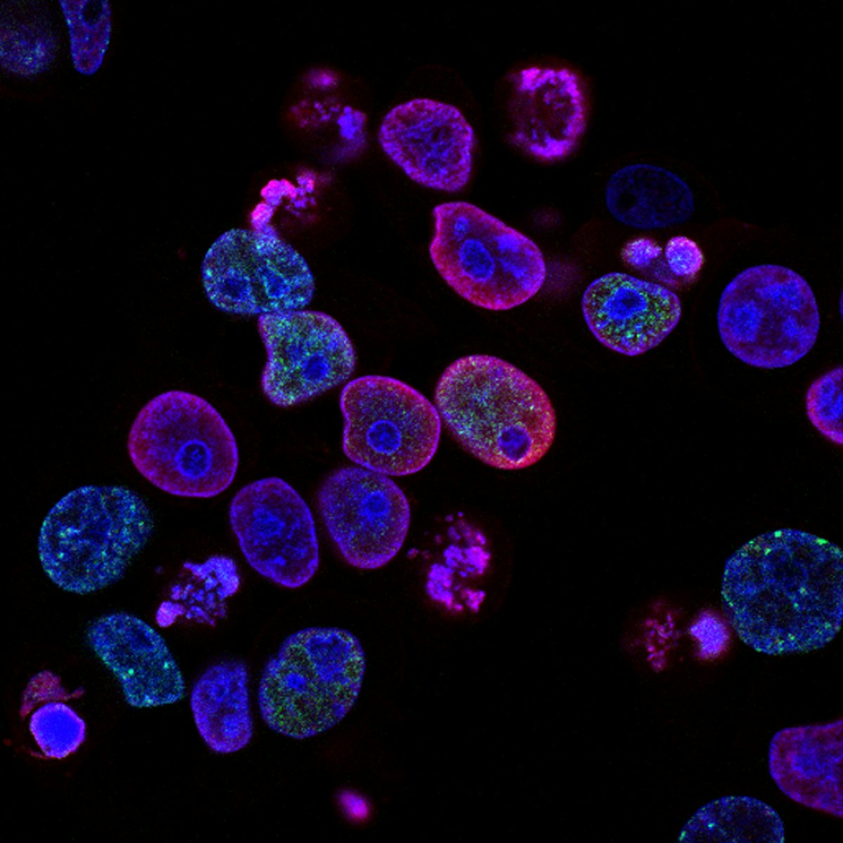 Fluorescence microscopy of cell nuclei
